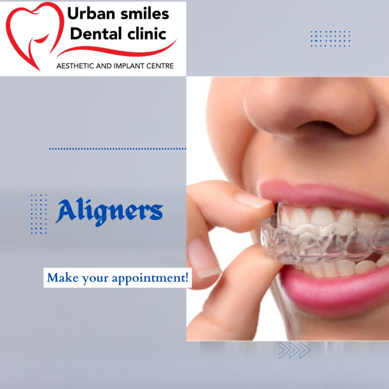 aliger