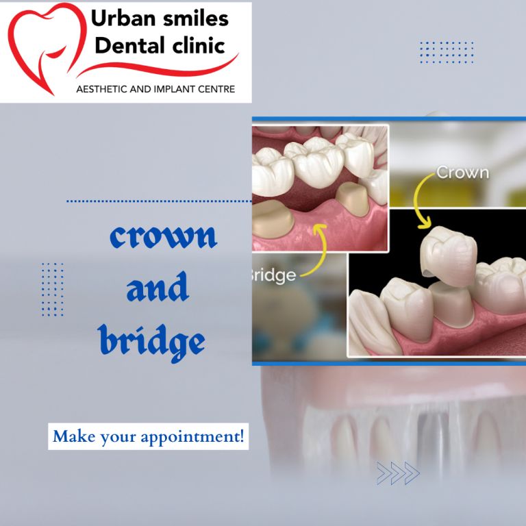 crown