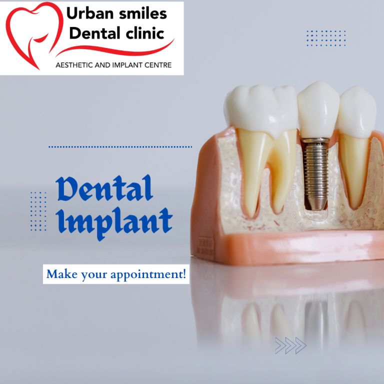 implant