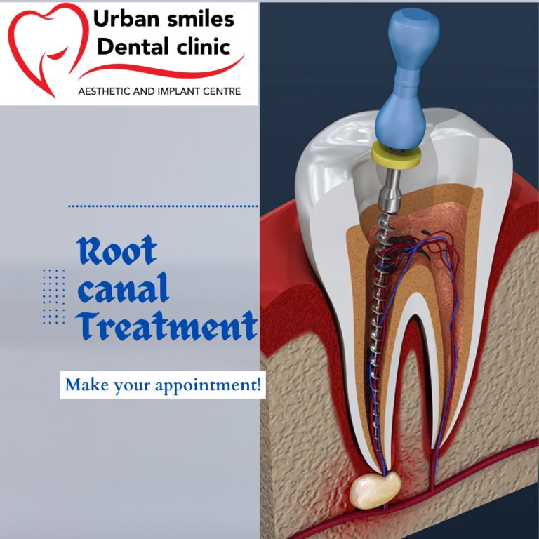 root